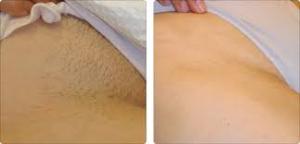 Wholesale Profession hair removal portable 808nm diode laser hair removal machine from china suppliers
