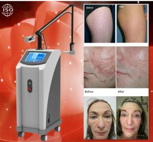 Wholesale Cutting/beauty/Virginal mode RF tube CO2 Fractional laser freckles pigment age spots removal beauty machine from china suppliers
