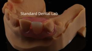 Wholesale Dental TCS Valplast Flexible Partial Dentures Nesbit Valplast Finish China Dental Lab Valplast Clasp from china suppliers