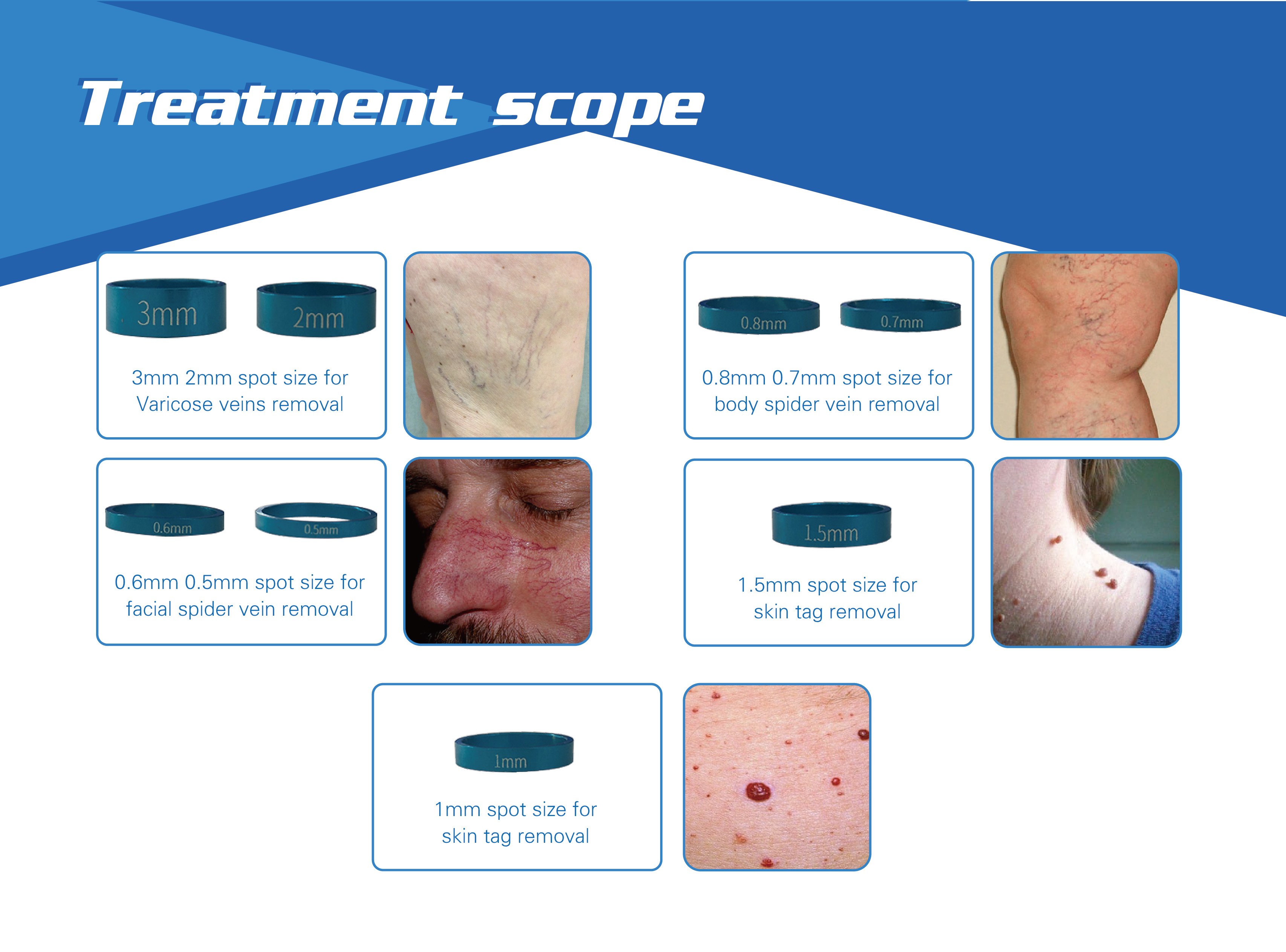 2018 updated spider veins nose treatment rbs vascular machine spider vein removal