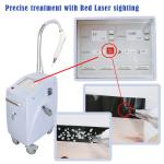 Nd Yag Q Switched Laser Device Tattoos Removal Machine