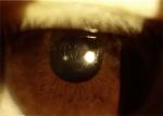 Handheld Slit Lamp Portable Ophthalmoscope Camera