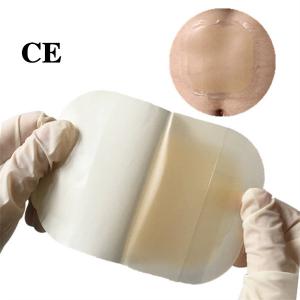 Wholesale CE EN13485 ISO Surgical Transparent Wound Dressing Waterproof from china suppliers