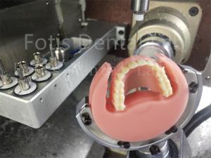 Wholesale Ivoclar Natural Color Full Acrylic Denture Comfort Fit Prosthesis With Esthetics from china suppliers