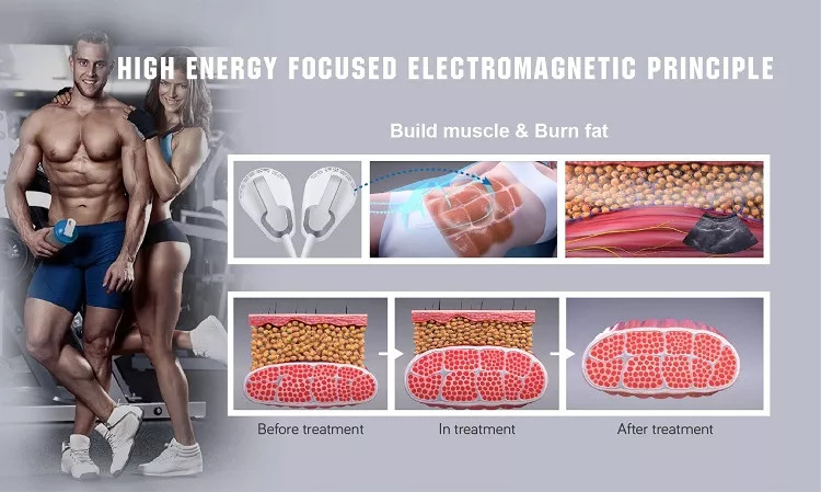 Portable Touch Screen Em Body Sculpting Machine For Weight Loss