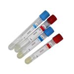 PRP Tube 10ml With ACD Gel For Hair Loss Platelet Rich Plas Prp PRF Centrifuge