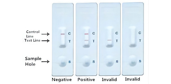 10min Infectious Bursal Disease (IBD) Avian Influenza Rapid Test Kit Antigen Elisa 50 Tests/Kit