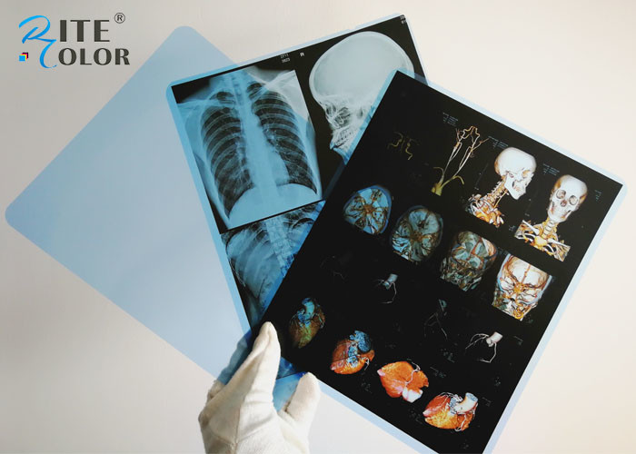 Medical Blue Sensitive X Ray Film PET Material For Image Inkjet Printing