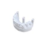 Dental CAD/CAM Repair Model Resin 3D Printing Photopolymer Resin