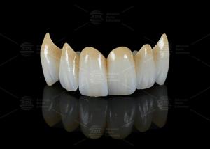 Wholesale High Translucency Full Contour Zirconia Bridge Chipping Resistance Natural Esthetics from china suppliers