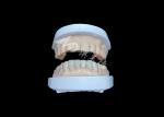 IPS Emax Veneers Natural Looking Restorations For Esthetic Smiles