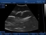 Medical Ultrasound Machine Portable Ultrasound Scanner 4d Ultrasound Equipment
