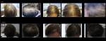 Top sale 650nm diode laser hair regrowth treatment with fast result