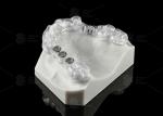 Custom Made Transparent Dental Implant Solution Surgical Stent Ergonomic Design