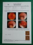 PET Based 125um 150um 180um Medical Dry Film White Inkjet X Ray Film OEM