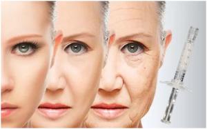 Wholesale Pcl Based Hyaluronic Acid Injection Products Serum Miracle Touch Up Skin from china suppliers