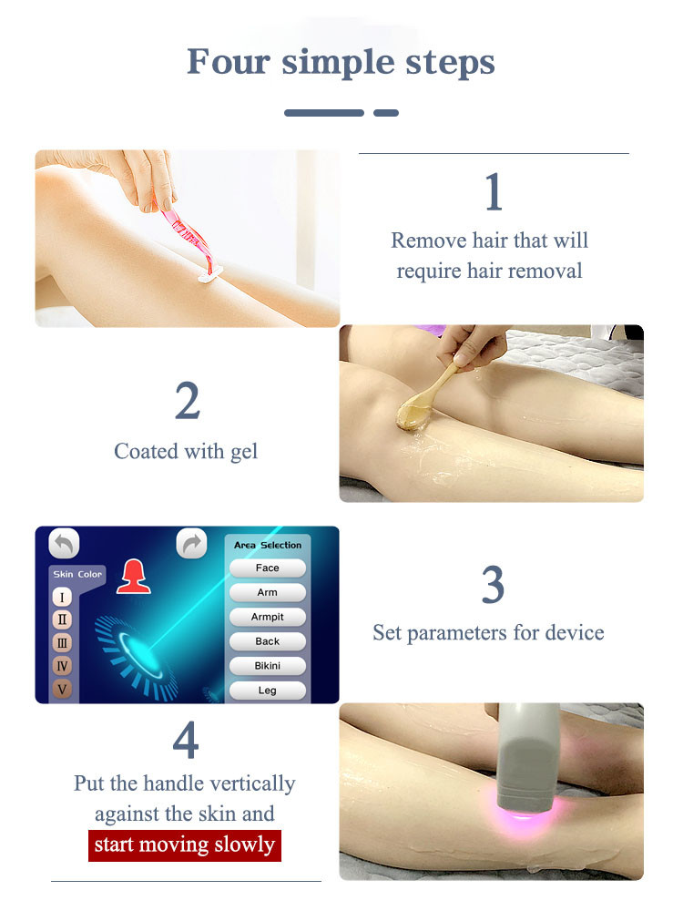 Newest Diode Laser 808 nm Alma Soprano ICE Diode Laser Hair Removal Machine Price