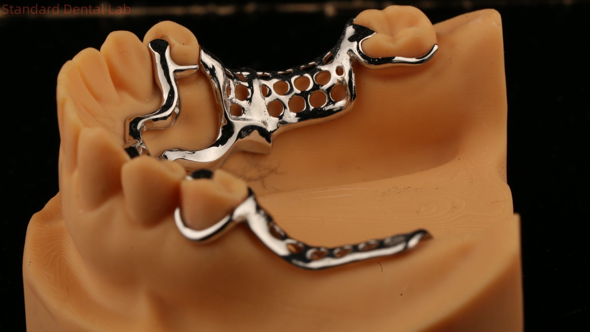 Upper Cast Metal Framework Partial Dentures Strong Lightweight And Durable