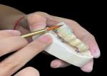 Customizable Polished Dental Implant Crown Bridge Long Lasting for Easy Hygiene