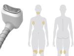 OEM & ODM salon use permanent cellulite cold body sculpting cryolipolysis fat