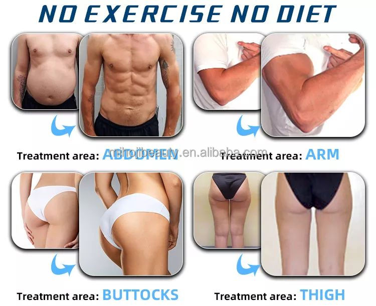 High Frequency Hiemt Sculpting Body Machine For Lifting Buttock And Reducing Cellulite