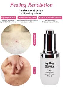 Wholesale Exfoliating Serum Skin Peeling Solution Acne Remover Skin Care Skin Peeling 30ml from china suppliers