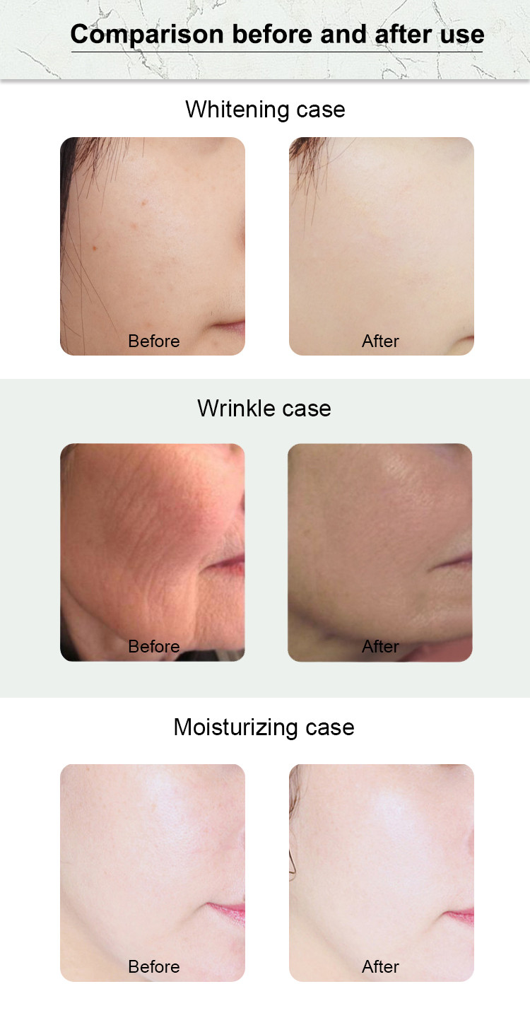 Skin Polishing Beauty Therapy Machines 10 In 1 Hydro Crystal Microdermabrasion Machine