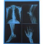 195 Microns PET X Ray Film 10x12 Inch Laser Blue X Ray Film For Fuji OKI Printer