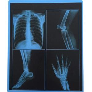 Wholesale 25cm X 30cm Blue Transparency PET Thermal Film Medical Dry Imaging Film For Hospital from china suppliers
