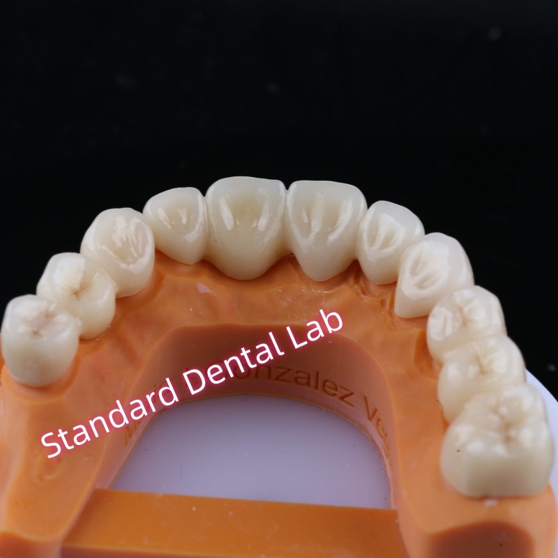Digital CAD CAM Milling Layered Zirconia Bridge Crown With Pink Porcelain