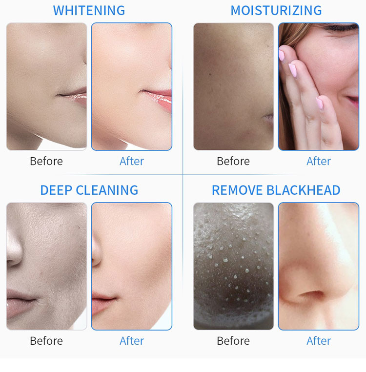 Aqua Peel Facial Hydrafacial Water Dermabrasion Machine 9 In 1 For Skin Clean
