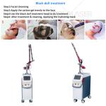 Q Switched Nd Yag Laser Body Machine Laser Skin Treatment Machine Eyebrow Tattoo