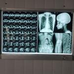 Resin A4 A3 Medical X Ray Film For Radiology Graphics