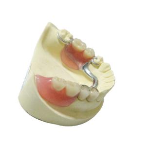 Wholesale Steel Removable Partial Dentures Denture Restoration Dental Lab Products from china suppliers