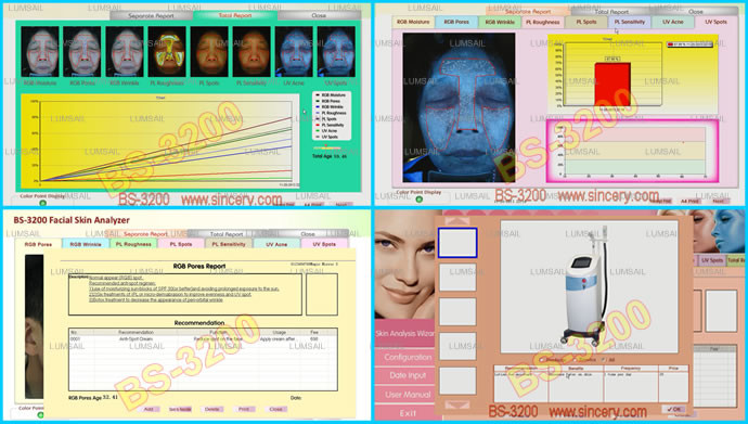 Auto - Analysis Skin Analysis Machine Lightweight With UV Voice System