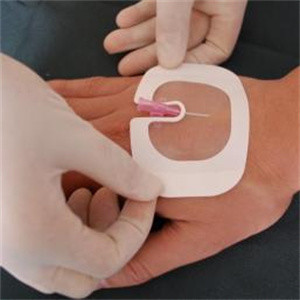Hospital Disposable Transparent Adhesive Film Dressing Transfusion Needle