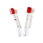 Manufacturers Price Medical Red Top 3ml 5ml 10ml Plain Sample Vacuum Blood Test