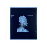 Medical X-ray Dry Film Medical X-ray Inkjet Film With Clear Image Quality