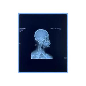 Wholesale Medical X-ray Dry Film Medical X-ray Inkjet Film With Clear Image Quality from china suppliers