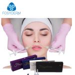 Facial Hyaluronic Acid Dermal Filler / Injectable Hyaluronic Acid Gel Long