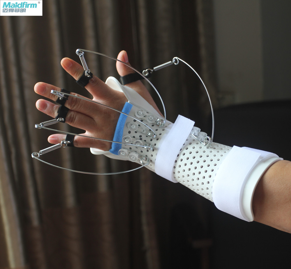 Thermoplastic Dynamic Extension Splint For Radial Nerve Palsy
