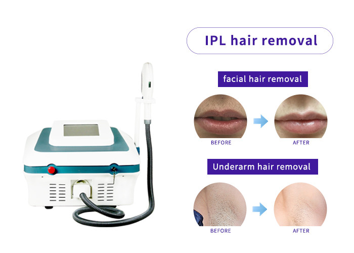 Acne Therapy Ipl Skin Rejuvenation Equipment , IPL Beauty Machine Big Handle 15 * 50mm