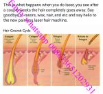 epilation Best hair removal,Diode laser hair removal,quickly and painless for