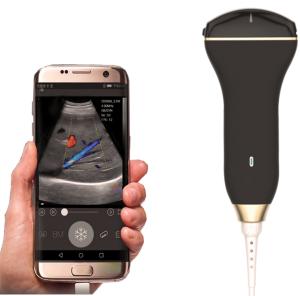 Wholesale Mobile Smart USB Color Doppler Ultrasound Probe For Laptop from china suppliers