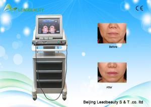Wholesale Face lift HIFU skin tightening wrinkle remover beauty machine from china suppliers