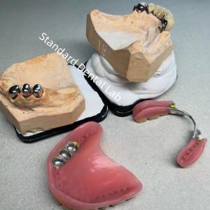 Wholesale High Esthetics CAD CAM Tooth Partial Denture Attachment Replacement Standard Dental Lab from china suppliers