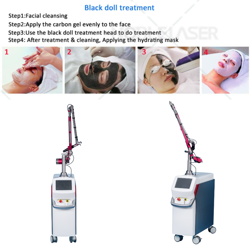 Q Switched Nd Yag Laser Body Machine Laser Skin Treatment Machine Eyebrow Tattoo Tattoo Equipment