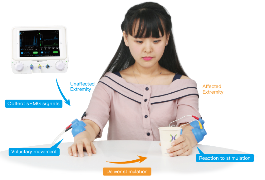 High Speed Emg Biofeedback Equipment Customize Treatment For Stroke Patients