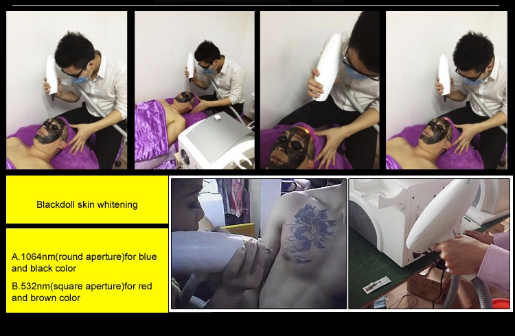 3 In 1 Q Switch ND Yag Laser Machine Tattoo Removal OEM ODM Services