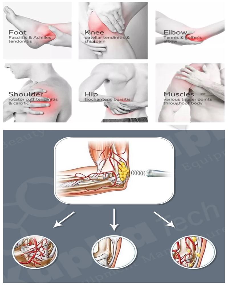 Physio Magneto Pulsed Shockwave Therapy Machine For Muscle Bone Joint Rehabilitation System